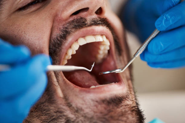 Best Emergency Tooth Extraction  in Pendleton, SC
